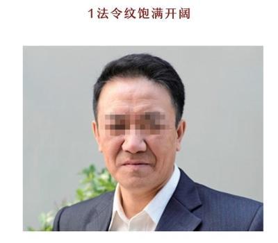 脸上4种法令纹事业有成又长寿 你有哪一种?