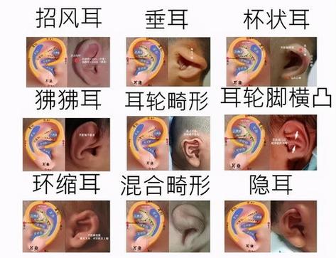 “穷人耳”、“富人耳”有没有科学依据(精灵耳面相)