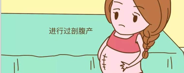 梦见自己剖腹生孩子(孕妇梦见剖腹产是胎梦吗)