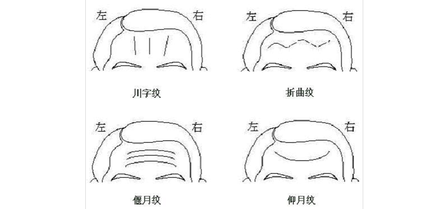 人文社科 文化/宗教 > 额头上的皱纹带给你的命运提示核心提示:在面相